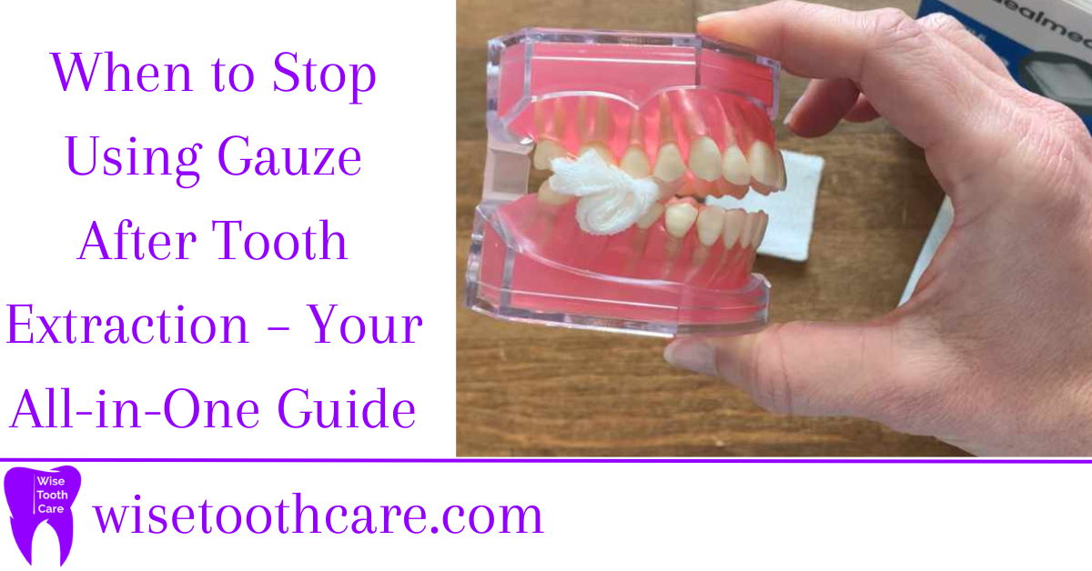 When to Stop Using Gauze After Tooth Extraction Your AllinOne Guide